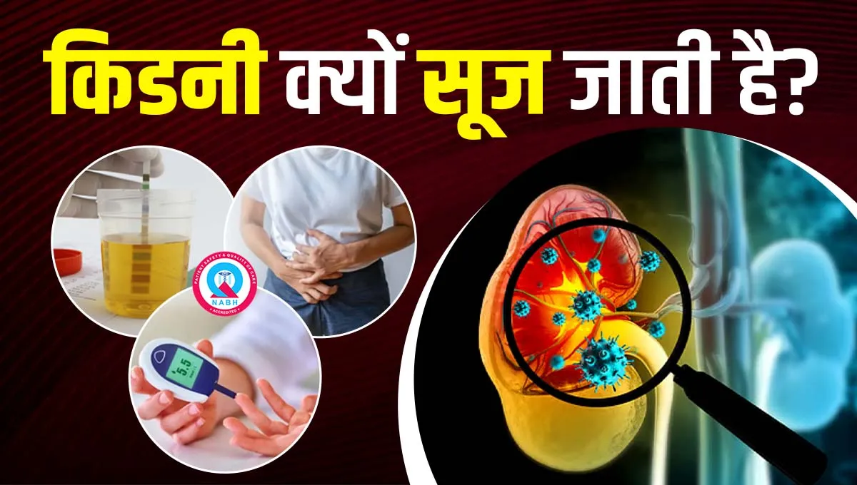 किडनी-क्यों-सूज-जाती-है